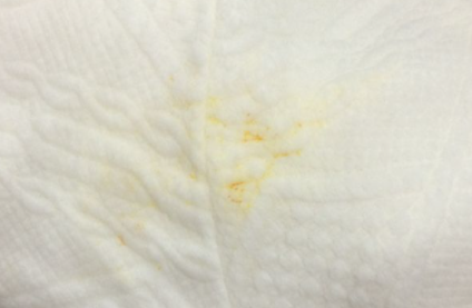黄色花粉能洗掉吗